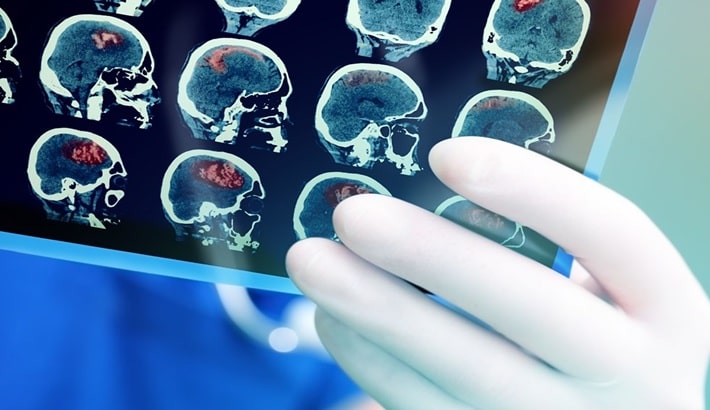 رادیولوژی در شیراز | تفسیر رادیولوژی