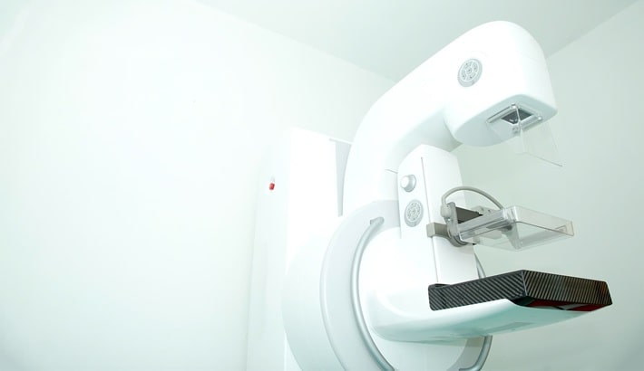 کیست سینه | نقش ماموگرافی