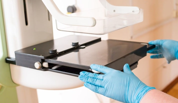 کیست سینه | بیوپسی یا نمونه‌برداری از کیست سینه