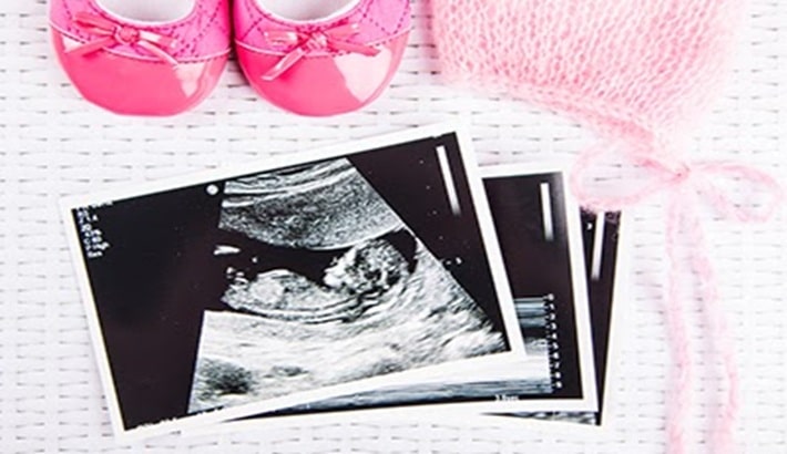 سونوگرافی | تعیین جنسیت سونوگرافی | تعیین جنسیت