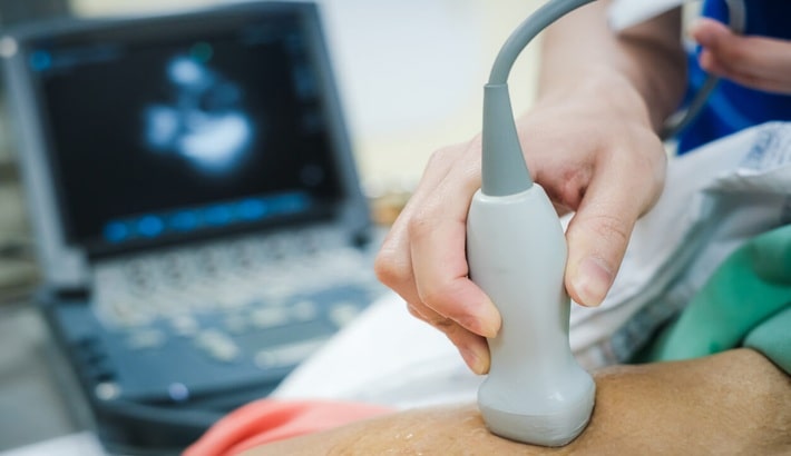 سونوگرافی | تشخیص آپاندیسیت سونوگرافی | تشخیص آپاندیسیت