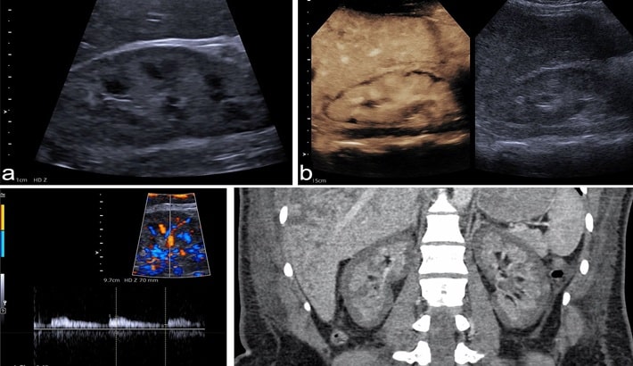 سونوگرافی در شیراز | آمادگی‌های لازم