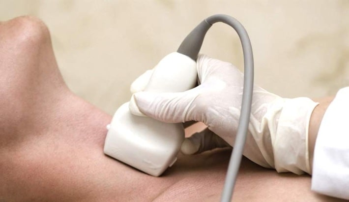 سونوگرافی | سونوگرافی تیروئید سونوگرافی | سونوگرافی تیروئید