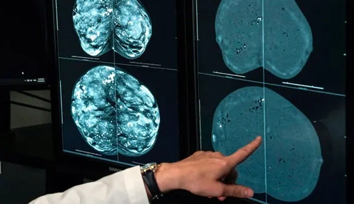 بهترین مرکز ماموگرافی شیراز | تفاوت بین ماموگرافی و سونوگرافی