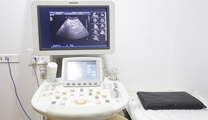 مرکز سونوگرافی | مزایای دستگاه سونوگرافی چهاربعدی