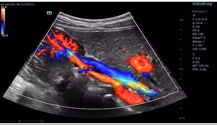 بهترین مرکز سونوگرافی شیراز | سونوگرافی داپلر رنگی بهترین مرکز سونوگرافی شیراز | سونوگرافی داپلر رنگی