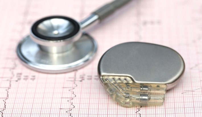 سی تی اسکن ریه | ظربان ساز یا ایمپلنت فلزی