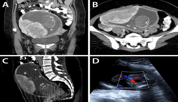 سی تی اسکن در شیراز | انجام سی تی اسکن در بارداری