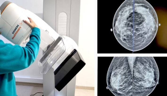 مرکز ماموگرافی | عوامل مؤثر بر تصمیمگیری مرکز ماموگرافی | عوامل مؤثر بر تصمیمگیری