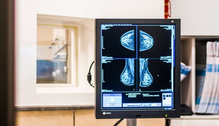ماموگرافی شیراز | مراکز ماموگرافی