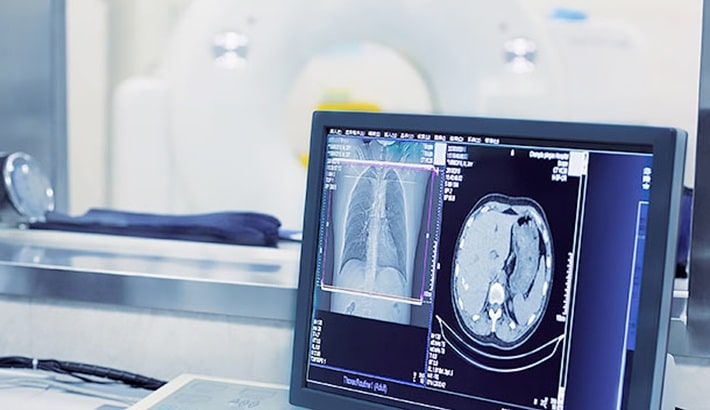 بهترین مرکز رادیولوژی شیراز | نرم‌افزارهای هوشمند
