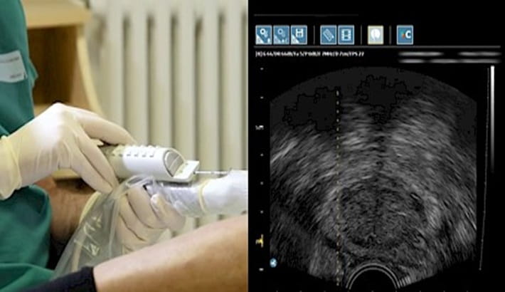 بهترین مرکز سونوگرافی شیراز | سونوگرافی پروستات بهترین مرکز سونوگرافی شیراز | سونوگرافی پروستات
