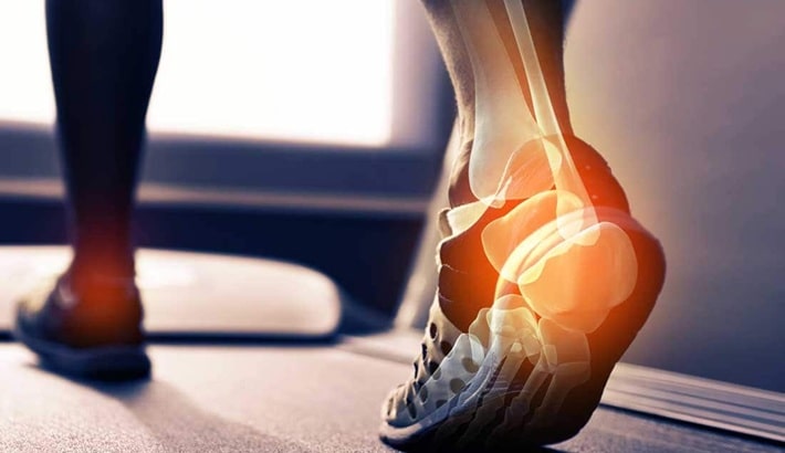 تراکم استخوان | بهترین ورزشها برای افزایش تراکم استخوان تراکم استخوان | بهترین ورزشها برای افزایش تراکم استخوان