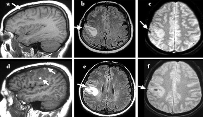 سی تی اسکن مغز | مدت زمان انجام سی تی اسکن مغز | مدت زمان انجام