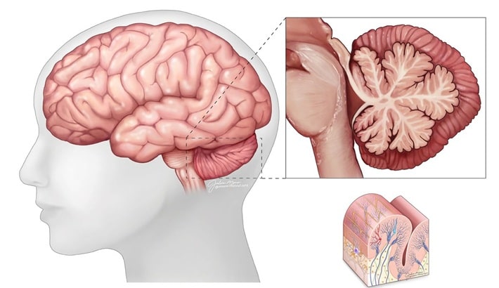 علت سرگیجه چیست | اختلالات مخچه علت سرگیجه چیست | اختلالات مخچه