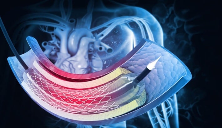 علت سرگیجه چیست | مشکلات قلبی عروقی
