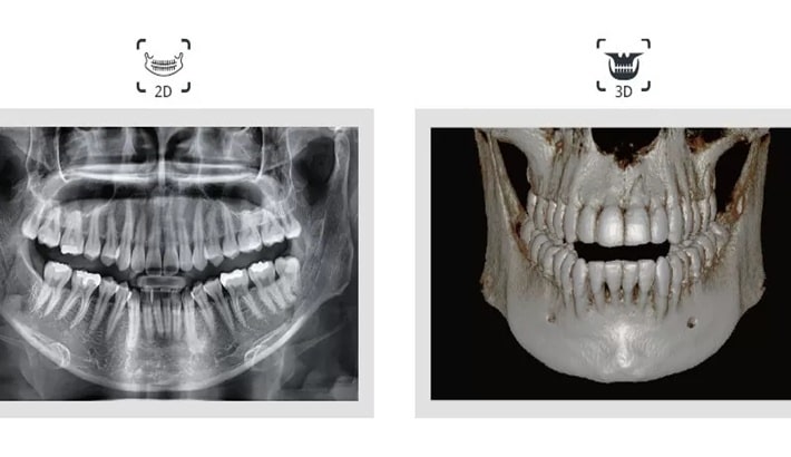 عکس opg دندان | تفاوت عکس opg شیراز با سیتیاسکن دندان عکس opg دندان | تفاوت عکس opg شیراز با سیتیاسکن دندان