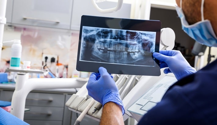 عکس opg شیراز | نکات مهم