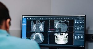 سی تی اسکن فک و دهان